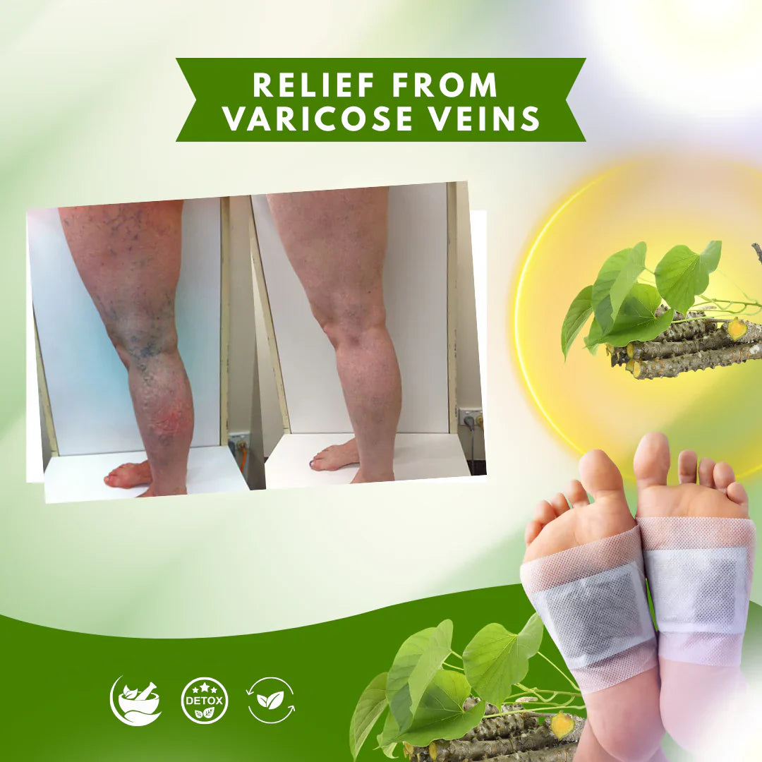 Herbal Giloy Detox Foot Patches Buy10 Get 20 (Pack of 30)